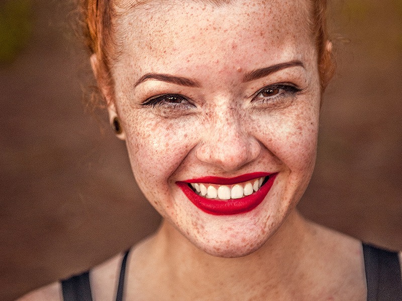 freckles on a woman's face